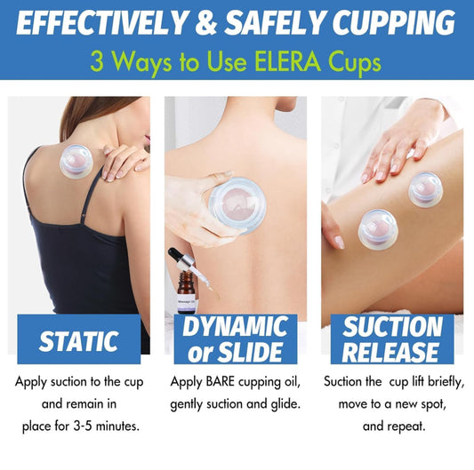 Cupping Massage